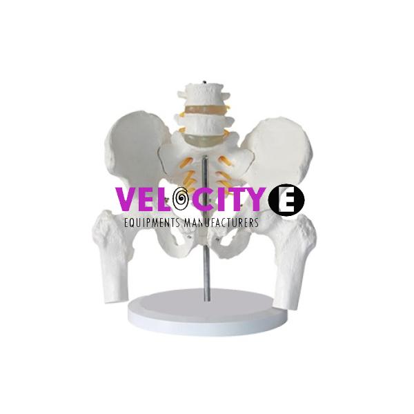 Pelvis And Lumbar Vertebrae and Femoral He